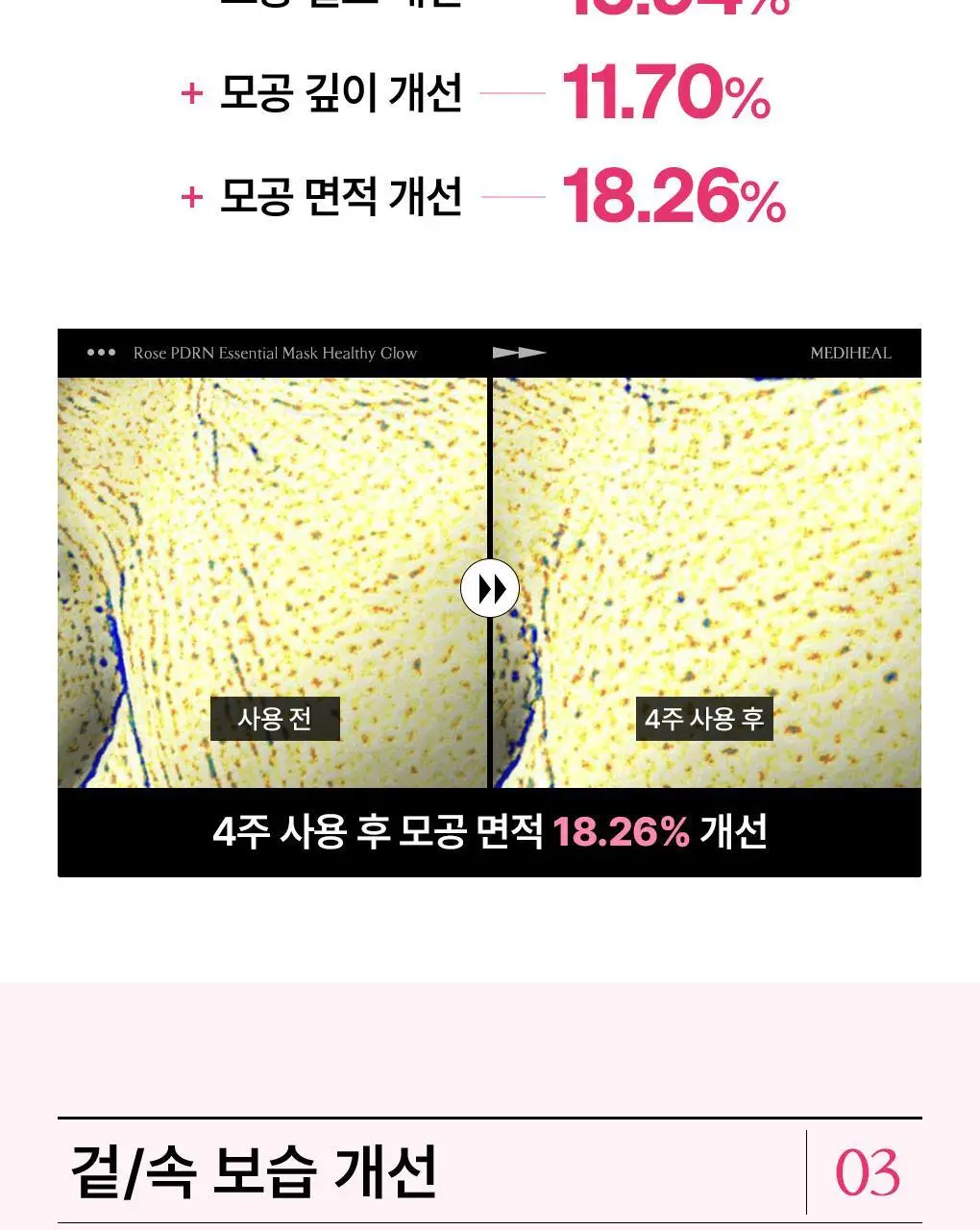 [15년 연속 1위] 메디힐 에센셜 마스크팩 10매/10+1매 기획 7종 골라담기 상세페이지 34
